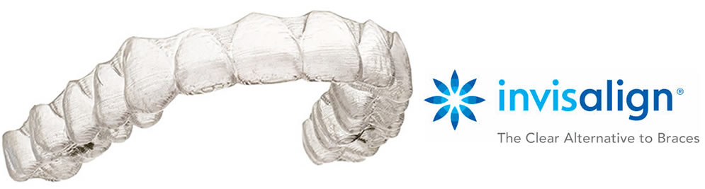 invisalign