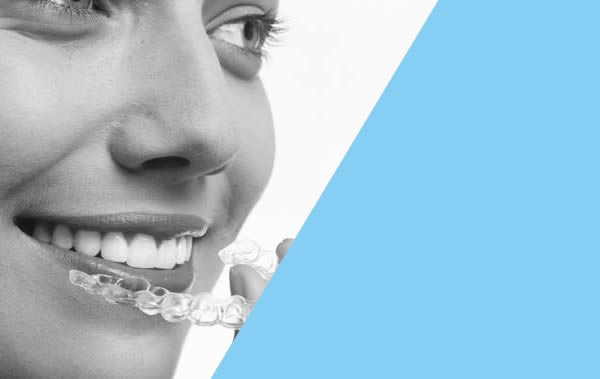 ceramic braces
