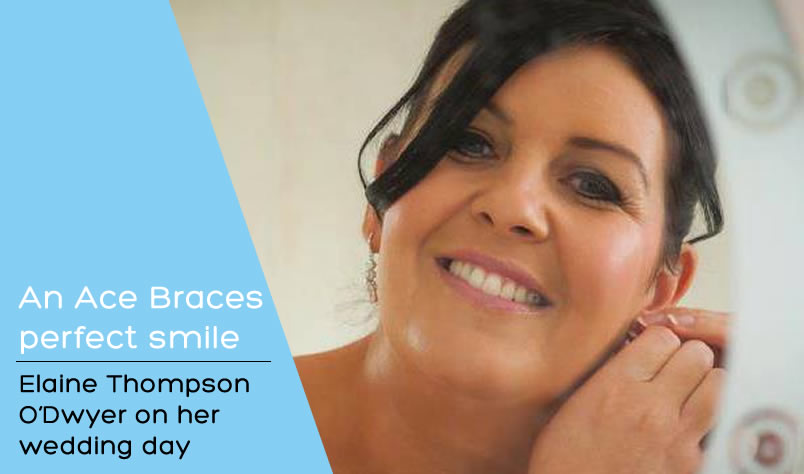 wedding smile from ace braces tullamore ireland